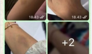 Akun IG Meysinputri Dilaporakan Ke Polda Banten Karena Dianggap Melanggar UU ITE & Membuat Kegaduhan