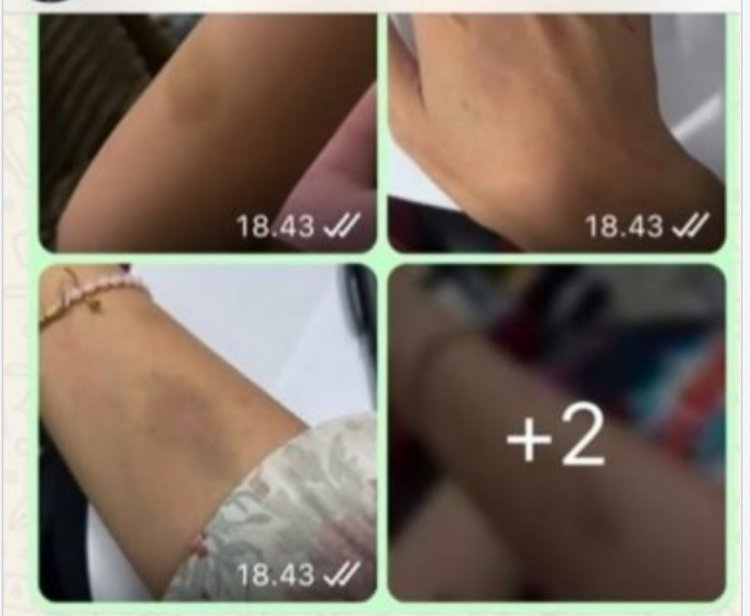 Akun IG Meysinputri Dilaporakan Ke Polda Banten Karena Dianggap Melanggar UU ITE & Membuat Kegaduhan